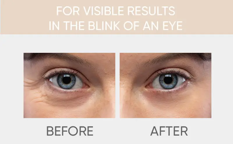 Celor Under Eye Patches for Puffy Eyes and Dark Circles 2 Celor Under Eye Patches for Puffy Eyes Before and After