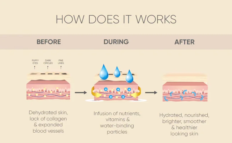 Celor Under Eye Patches for Puffy Eyes - How it works